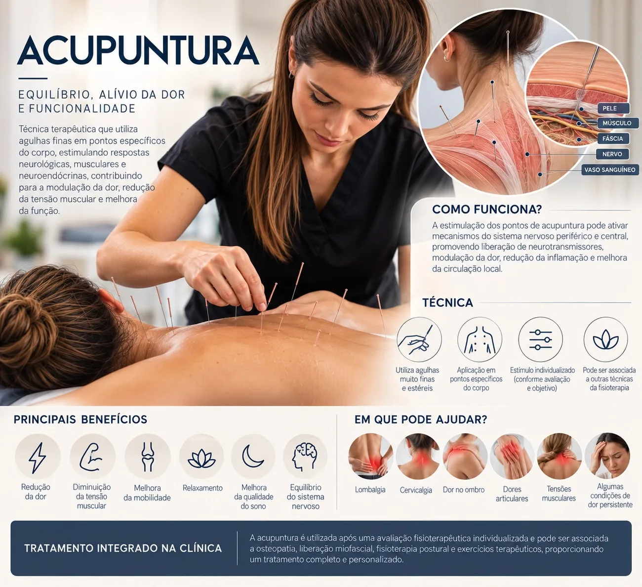 Acupuntura: ilustração explicativa